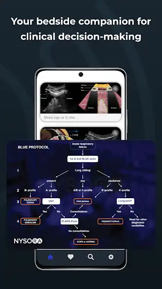 Play Point of Care Ultrasound as an online game Point of Care Ultrasound with UptoPlay