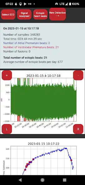 Play Polar H10 Arrhythmia as an online game online Polar H10 Arrhythmia with UptoPlay Play Polar H10 Arrhythmia as an online game Polar H10 Arrhythmia with UptoPlay