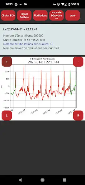 Play Polar H10 Atrial Fibrillation and enjoy Polar H10 Atrial Fibrillation with UptoPlay Play Polar H10 Atrial Fibrillation and enjoy Polar H10 Atrial Fibrillation with UptoPlay