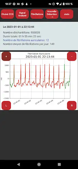 Play Polar H10 Atrial Fibrillation as an online game online Polar H10 Atrial Fibrillation with UptoPlay Play Polar H10 Atrial Fibrillation as an online game Polar H10 Atrial Fibrillation with UptoPlay