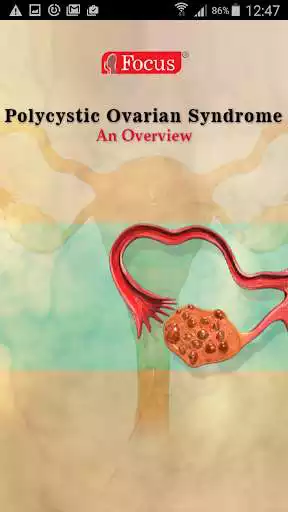 Play Polycystic ovarian syndrome Play Polycystic ovarian syndrome