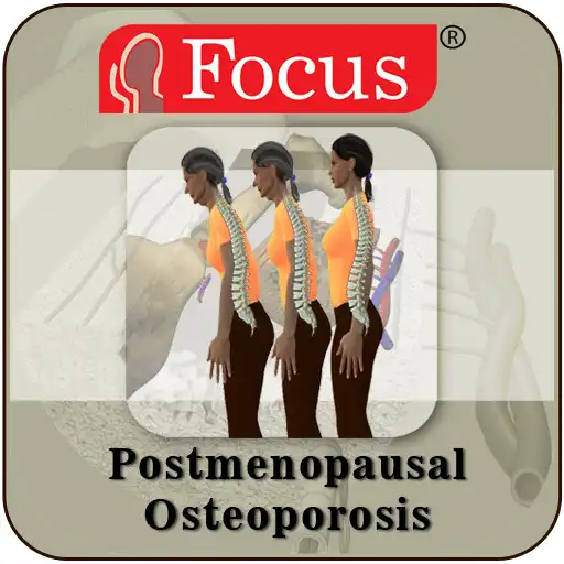 Play Postmenopausal Osteoporosis APK Play Postmenopausal Osteoporosis APK