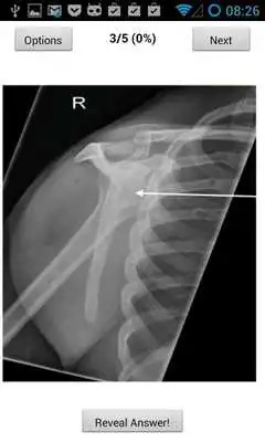 Play Powerpass FRCR Anatomy 2013