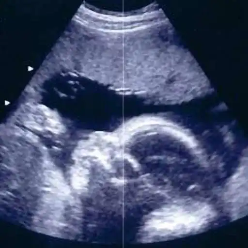 Play Pregnancy Today & Baby Kick APK