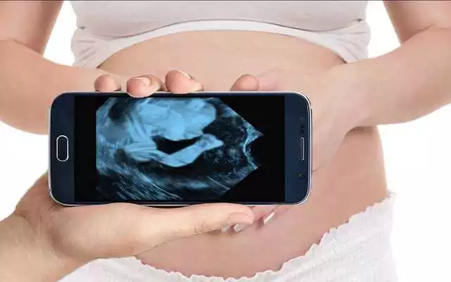 Play Pregnancy Ultrasound Scanner (Prank)