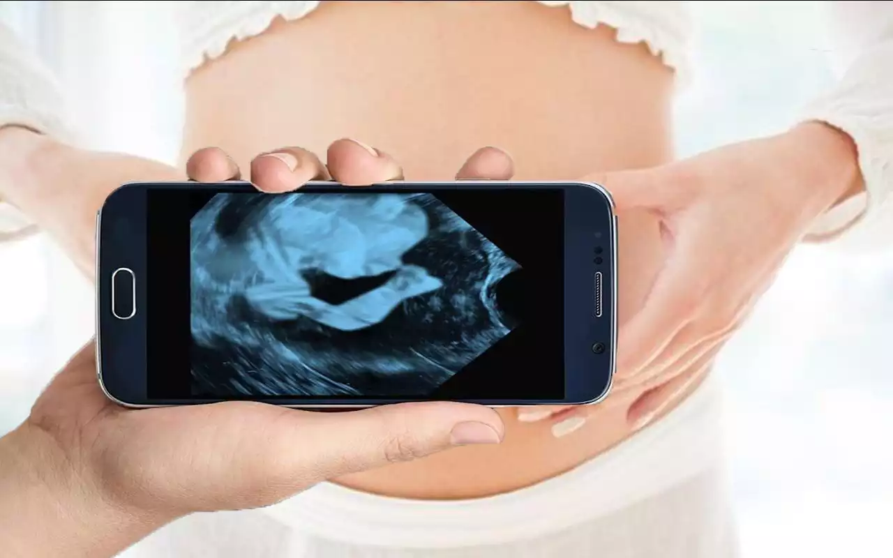 Play Pregnancy Ultrasound Scanner (Prank)