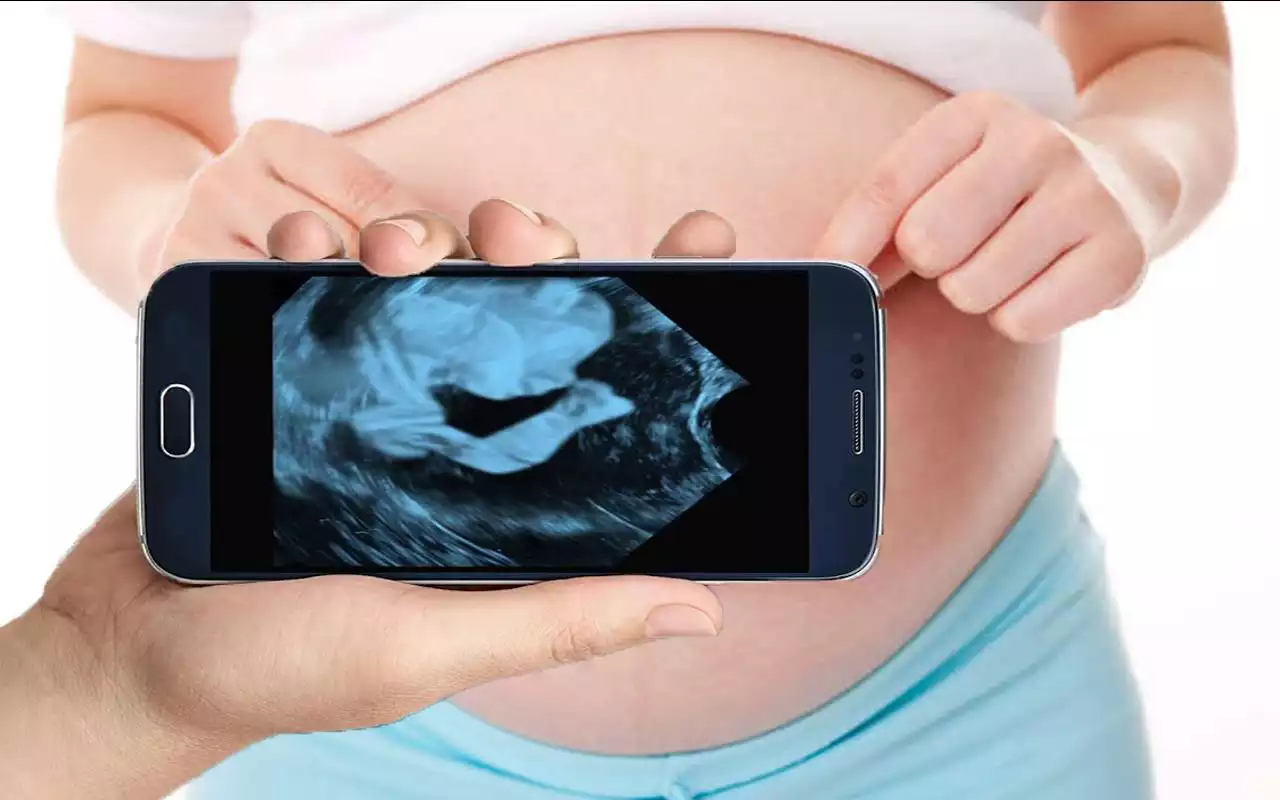 Play Pregnancy Ultrasound Scanner (Prank)