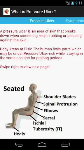 Play Pressure Ulcer as an online game Pressure Ulcer with UptoPlay