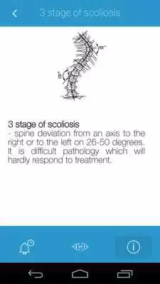 Play Prevent Scoliosis