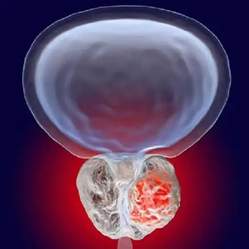 Play Prostate cancer APK Play Prostate cancer APK