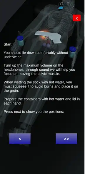 Play Prostate Heat Treatment as an online game Prostate Heat Treatment with UptoPlay