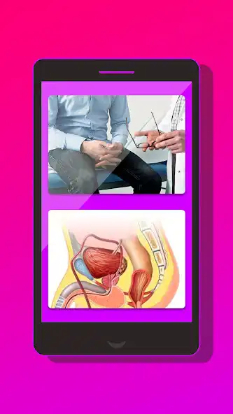 Play Prostatitis is very dangerous  and enjoy Prostatitis is very dangerous with UptoPlay