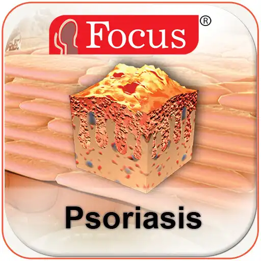 Play Psoriasis APK Play Psoriasis APK