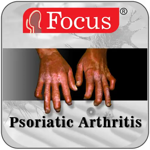 Play Psoriatic Arthritis APK Play Psoriatic Arthritis APK