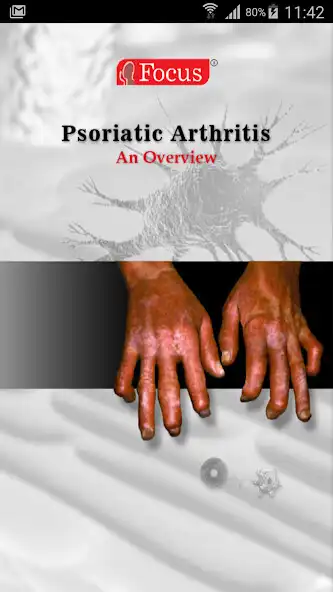 Play Psoriatic Arthritis  and enjoy Psoriatic Arthritis with UptoPlay