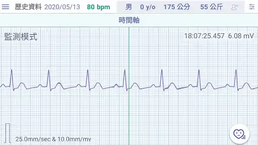 Play Q-ecg as an online game Q-ecg with UptoPlay