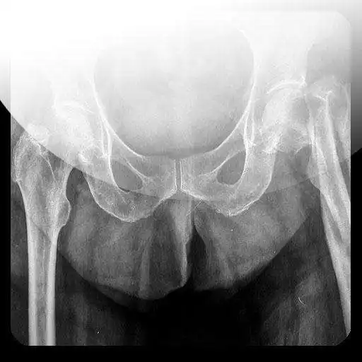 Run free android online Radiografias de examenes APK