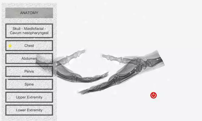 Playing Radiographic Radiographic Anatomy X-Ray online game with UptoPlay