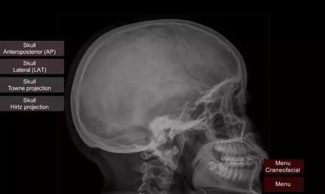 Playing Radiographic Radiographic Anatomy X-Ray online game with UptoPlay