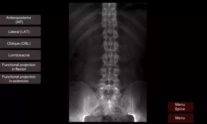 Playing Radiographic Radiographic Anatomy X-Ray online game with UptoPlay