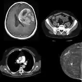 Free play online Radiology Flashcards: Free APK Free play online Radiology Flashcards: Free APK