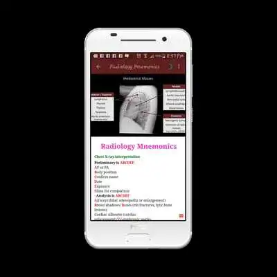 Playing Radiographic Radiology Mnemonics online game with UptoPlay