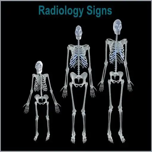 Run free android online Radiology Signs APK Run free android online Radiology Signs APK