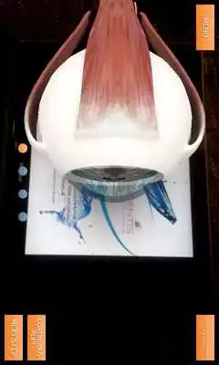 Play Ranibizumab Play Ranibizumab