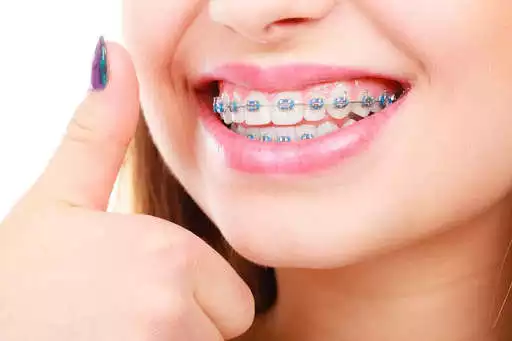 Play APK Real Braces Teeth  and enjoy Real Braces Teeth with UptoPlay com.lab.photo.editor.real.braces.teeth