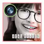 Free play online Real Cute Brace Editor APK