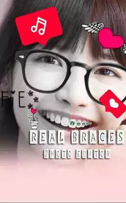 Play Real Cute Brace Editor