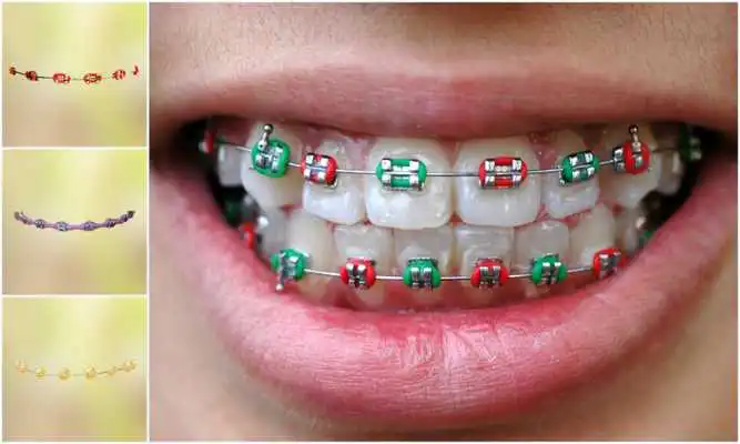 Play Real Teeth Braces Photo Maker