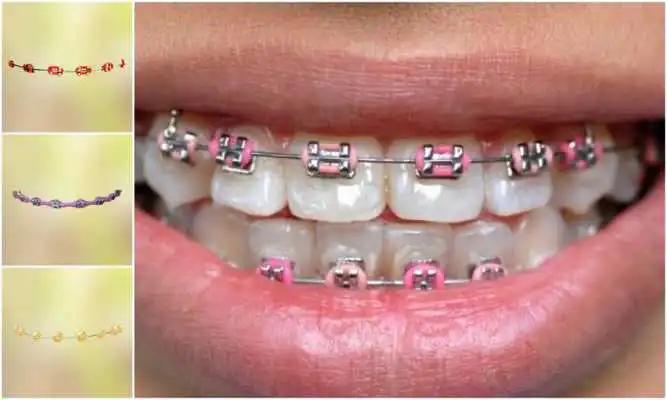 Play Real Teeth Braces Photo Maker