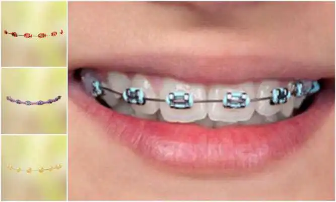 Play Real Teeth Braces Photo Maker