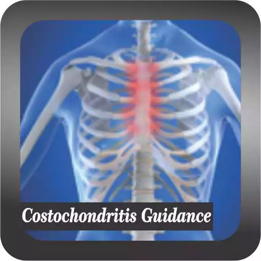 Play Recognize Costochondritis Guidance APK