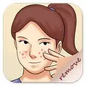Free play online Remove Pimples Guide APK
