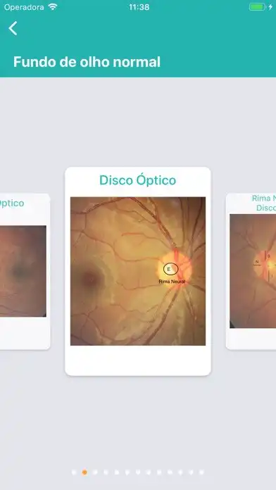 Play Retina Fácil as an online game Retina Fácil with UptoPlay