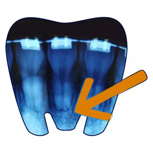 Play Root Resorption APK Play Root Resorption APK