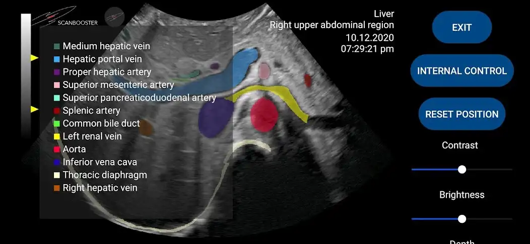 Play Scanbooster Ultrasound Simulator  and enjoy Scanbooster Ultrasound Simulator with UptoPlay