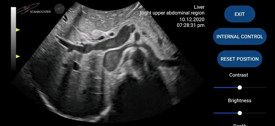 Play Scanbooster Ultrasound Simulator as an online game Scanbooster Ultrasound Simulator with UptoPlay