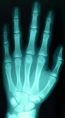 Play Scanner-xray radiology pranks Play Scanner-xray radiology pranks