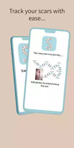 Play ScarTracker  and enjoy ScarTracker with UptoPlay