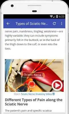 Play Sciatic nerve pain