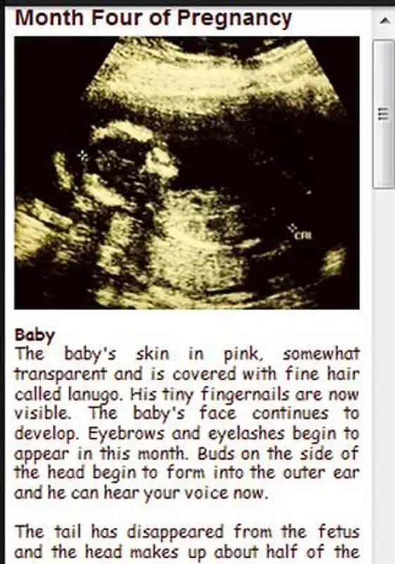 Play Second Pregnancy Trimester