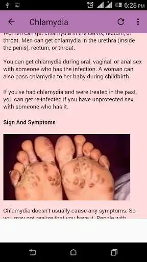 Play Sexually transmitted diseases as an online game Sexually transmitted diseases with UptoPlay