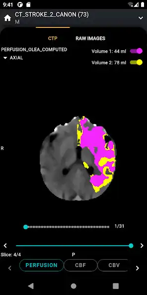 Play S.I.A Neurovascular Care  and enjoy S.I.A Neurovascular Care with UptoPlay