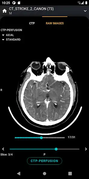 Play S.I.A Neurovascular Care as an online game S.I.A Neurovascular Care with UptoPlay