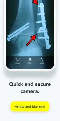 Play Siilo Play Siilo