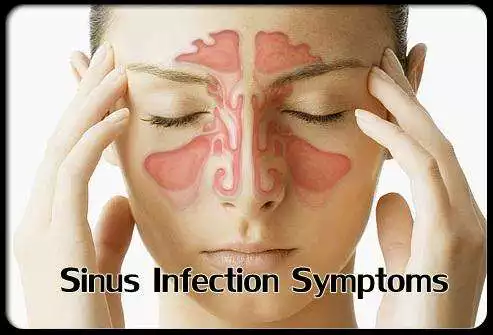 Play Sinus Infection Symptoms