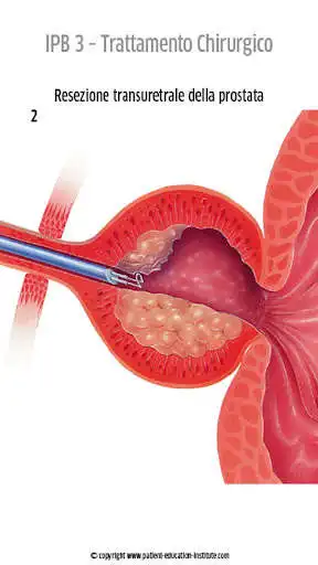 Play SIU, Urologia, phone app  and enjoy SIU, Urologia, phone app with UptoPlay